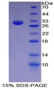 SDS-PAGE